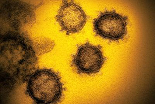 Coloured transmission electron micrograph (TEM) of SARS-CoV-2 coronavirus particles isolated from a US case of the disease Covid-19. SARS-CoV-2 (previously 2019-nCoV) was first identified in Wuhan, China, in December 2019. It is an enveloped RNA (ribonucleic acid, dark) virus. The coronaviruses take their name from their crown (corona) of surface proteins, which are used to attach and penetrate their host cells. Covid-19 is a respiratory infection that can lead to fatal pneumonia. As of the 18th February 2020, over 70,000 have been infected in China with over 1,700 deaths. There have been over 750 confirmed cases outside of China, with three deaths. In China travel restrictions and infection control measures have been put in place to slow the spread of the virus.